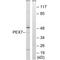 Peroxisomal Biogenesis Factor 7 antibody, A05365, Boster Biological Technology, Western Blot image 