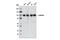 Actinin Alpha 1 antibody, 6487S, Cell Signaling Technology, Western Blot image 