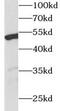 WT1 Transcription Factor antibody, FNab09528, FineTest, Western Blot image 
