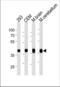 Aldolase, Fructose-Bisphosphate C antibody, TA324945, Origene, Western Blot image 