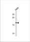 NADH:Ubiquinone Oxidoreductase Subunit B10 antibody, TA325189, Origene, Western Blot image 