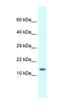 Small Nuclear Ribonucleoprotein D1 Polypeptide antibody, orb324890, Biorbyt, Western Blot image 