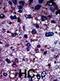 Phosphofructokinase, Muscle antibody, abx033896, Abbexa, Immunohistochemistry frozen image 