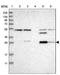 Carbonic anhydrase 13 antibody, NBP1-86606, Novus Biologicals, Western Blot image 