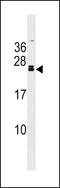 Fibroblast growth factor 20 antibody, 60-454, ProSci, Western Blot image 