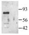 Serine/threonine-protein kinase PAK 1 antibody, PA1-28385, Invitrogen Antibodies, Western Blot image 