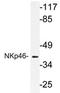 Natural Cytotoxicity Triggering Receptor 1 antibody, AP21199PU-N, Origene, Western Blot image 