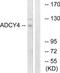 Adenylate Cyclase 4 antibody, TA316212, Origene, Western Blot image 