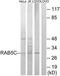 Ras-related protein Rab-5C antibody, TA314414, Origene, Western Blot image 