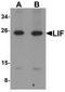 HILDA antibody, TA319675, Origene, Western Blot image 