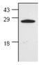 BLK Proto-Oncogene, Src Family Tyrosine Kinase antibody, PA1-26456, Invitrogen Antibodies, Western Blot image 