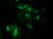 Eukaryotic Translation Initiation Factor 4E Family Member 2 antibody, TA502403, Origene, Immunofluorescence image 