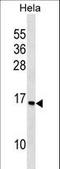 Ribosomal Protein S14 antibody, LS-C162731, Lifespan Biosciences, Western Blot image 