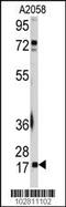 Ubiquitin Conjugating Enzyme E2 I antibody, MBS9202059, MyBioSource, Western Blot image 