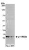Cyclin-dependent kinase inhibitor 2A, isoforms 1/2/3 antibody, A301-267A, Bethyl Labs, Western Blot image 