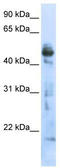 3-Oxoacyl-ACP Synthase, Mitochondrial antibody, TA339340, Origene, Western Blot image 