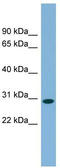NKAP Domain Containing 1 antibody, TA344915, Origene, Western Blot image 
