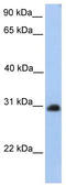 Carbohydrate Sulfotransferase 14 antibody, TA329573, Origene, Western Blot image 