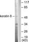 Keratin 8 antibody, TA313111, Origene, Western Blot image 