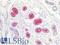 Sialyl Lewis a antibody, LS-B8617, Lifespan Biosciences, Immunohistochemistry paraffin image 