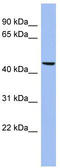 Matrilin 3 antibody, TA337661, Origene, Western Blot image 