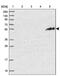 PiggyBac Transposable Element Derived 4 antibody, PA5-59343, Invitrogen Antibodies, Western Blot image 