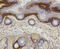 Collagen Type XVII Alpha 1 Chain antibody, 13-819, ProSci, Immunohistochemistry paraffin image 