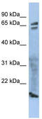 Zona Pellucida Glycoprotein 1 antibody, TA335102, Origene, Western Blot image 