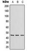 Zinc Finger Protein 174 antibody, GTX55226, GeneTex, Western Blot image 