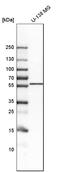Protein lunapark antibody, HPA014205, Atlas Antibodies, Western Blot image 