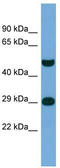 Neuronal PAS Domain Protein 3 antibody, TA345567, Origene, Western Blot image 