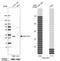 Estradiol 17-beta-dehydrogenase 12 antibody, HPA016427, Atlas Antibodies, Western Blot image 