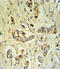 Fibrinogen Beta Chain antibody, abx032843, Abbexa, Immunohistochemistry paraffin image 