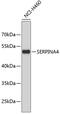 Serpin Family A Member 4 antibody, 19-249, ProSci, Western Blot image 