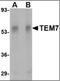 Plexin Domain Containing 1 antibody, orb88410, Biorbyt, Western Blot image 