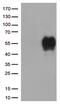 Hepatitis A Virus Cellular Receptor 2 antibody, TA812503S, Origene, Western Blot image 