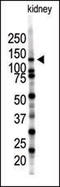 SUMO Specific Peptidase 7 antibody, AP11244PU-N, Origene, Western Blot image 