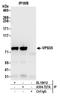 Vacuolar protein sorting-associated protein 35 antibody, A304-727A, Bethyl Labs, Immunoprecipitation image 