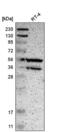 Protein Phosphatase 3 Catalytic Subunit Beta antibody, NBP2-58920, Novus Biologicals, Western Blot image 