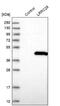 Leucine Rich Repeat Containing 28 antibody, NBP2-48726, Novus Biologicals, Western Blot image 