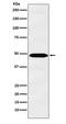 Interleukin 13 Receptor Subunit Alpha 1 antibody, M04527-1, Boster Biological Technology, Western Blot image 