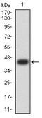 Neurofibromin 1 antibody, orb322990, Biorbyt, Western Blot image 