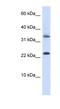 Homeobox protein EMX1 antibody, NBP1-79222, Novus Biologicals, Western Blot image 