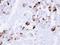 CAC antibody, GTX105562, GeneTex, Immunohistochemistry paraffin image 