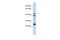 Selenoprotein P antibody, A02737, Boster Biological Technology, Western Blot image 
