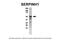 Serpin Family H Member 1 antibody, AVARP09002_T100, Aviva Systems Biology, Immunoprecipitation image 