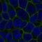 Solute Carrier Family 7 Member 2 antibody, PA5-64928, Invitrogen Antibodies, Immunofluorescence image 