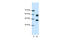 26S protease regulatory subunit 8 antibody, 28-816, ProSci, Western Blot image 