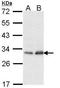 Phosphomannomutase 2 antibody, TA308120, Origene, Western Blot image 