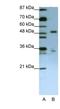 UPF3B Regulator Of Nonsense Mediated MRNA Decay antibody, NBP1-57232, Novus Biologicals, Western Blot image 